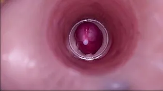 Female Insemination - Internal Camera Captures Deep Male Ejaculation