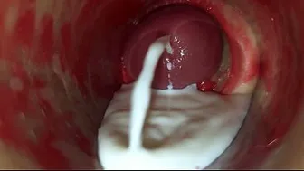 Camera Inside Deep Pussy Captures Huge Ejaculation of Sperm ASMR