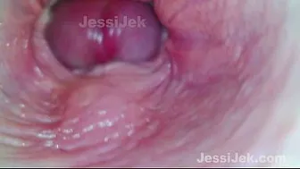 Dream babe got Twice Creampie Endoscope inside showed Extreme Fuck JessiJek