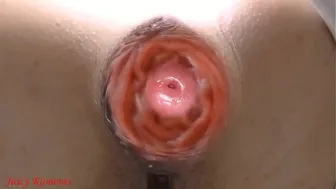 Anal slut lost her asshole prolapse while peeing in public toilet